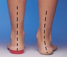 insoles1