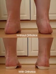 insoles2