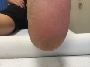 heel 2